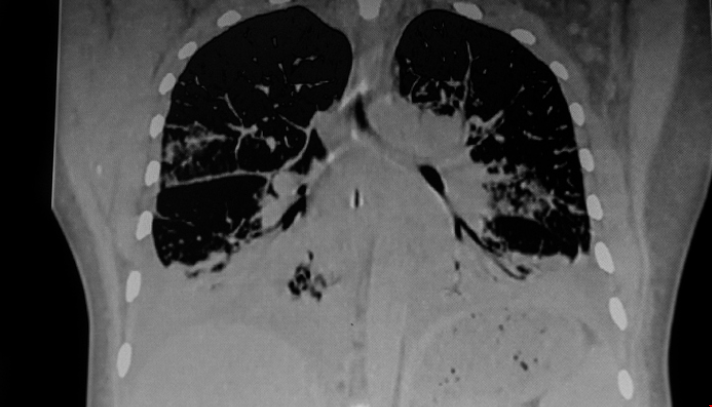 諾丁漢大學(xué)新研究中心將促進肺病疾病治療.png 諾丁漢大學(xué)新研究中心將促進肺病疾病治療.png